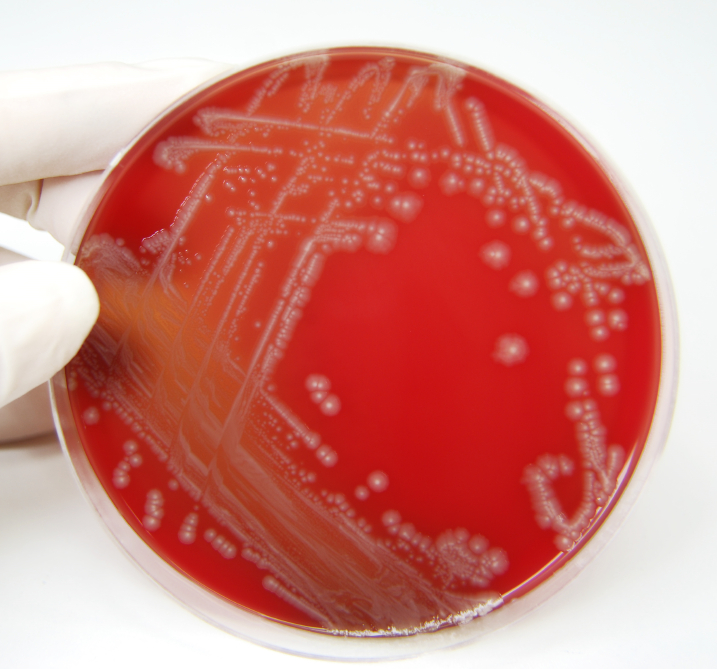 Agar Plate